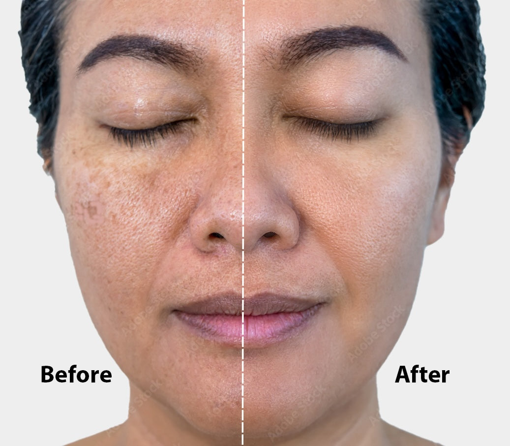 Sule Beauty - Stem C20 Facial Serum