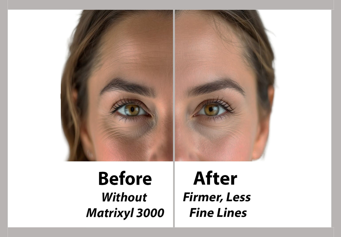 Matrixyl 3000 + Squalene