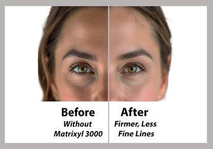 Matrixyl 3000 + Squalene